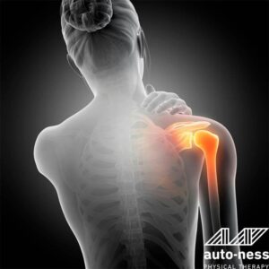 Navigating Shoulder Pain: From Impingement to Recovery